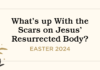What's up With the Scars on Jesus' Resurrected Body? by Jody Michele